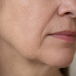 Facial Skin